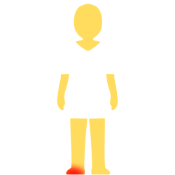 A person with no hair or face, an emoji yellow skintown, and a white pair of shorts and pants with no visible divider between the two. there's a glowing red spot on their left foot.